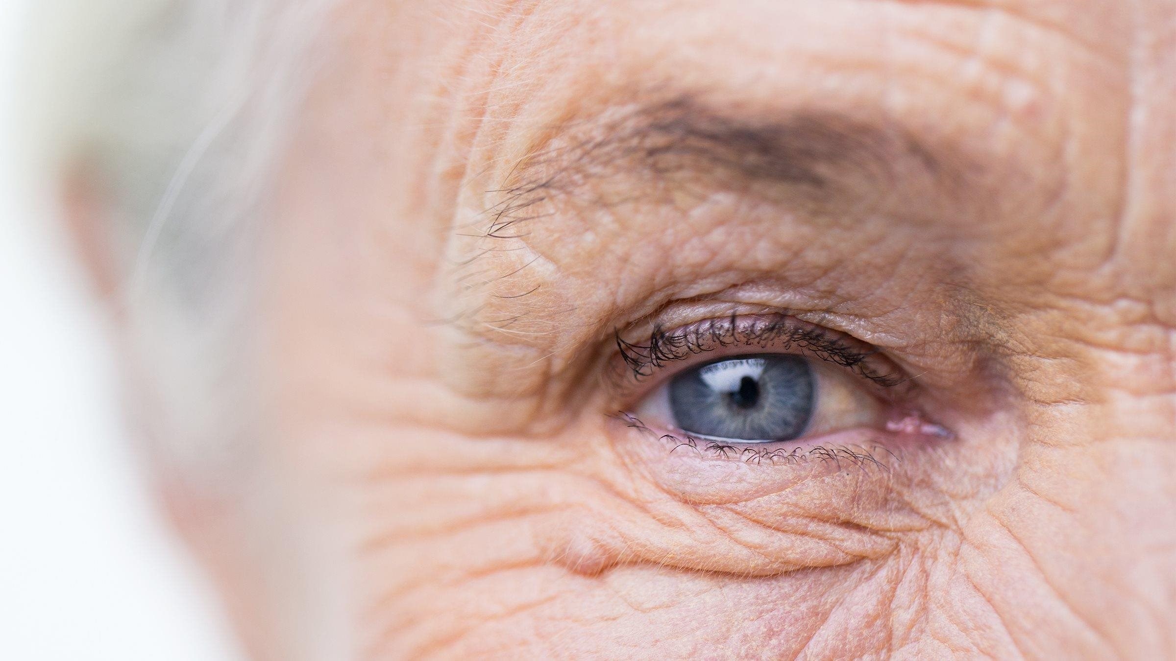 NICE Guideline - Age-related macular degeneration: diagnosis and ...